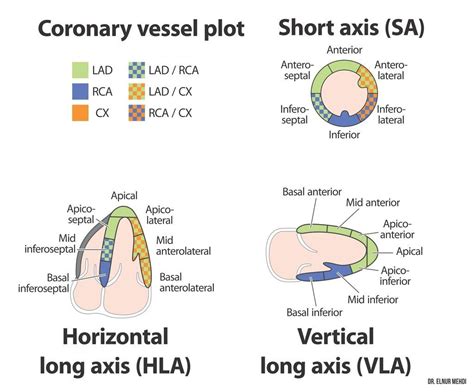 LV segmental anatomy .